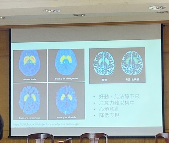 圖片標題:圖六：攝取過多糖分的腦與毒品古柯鹼產生相同反應