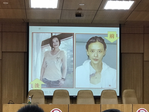 圖片標題:03吸毒前後變化